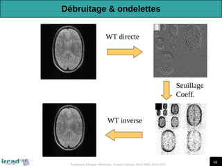 68
Traitement d'Images Médicales, Arnaud Charnoz, Ircad R&D 2012-2013
WT directe
WT inverse
Seuillage
Coeff.
Débruitage & ondelettes
 