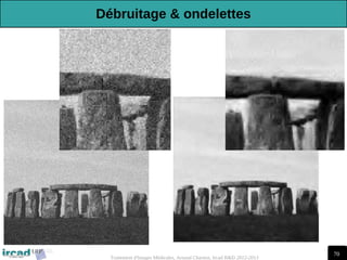 70
Traitement d'Images Médicales, Arnaud Charnoz, Ircad R&D 2012-2013
Débruitage & ondelettes
 
