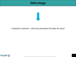 71
Traitement d'Images Médicales, Arnaud Charnoz, Ircad R&D 2012-2013
Limitation commune : choix des paramètres & temps de calcul
Débruitage
 