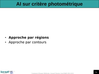 74
Traitement d'Images Médicales, Arnaud Charnoz, Ircad R&D 2012-2013
AI sur critère photométrique
• Approche par régions
• Approche par contours
 