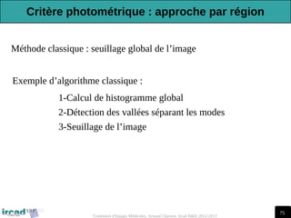 75
Traitement d'Images Médicales, Arnaud Charnoz, Ircad R&D 2012-2013
Méthode classique : seuillage global de l’image
Exemple d’algorithme classique :
1-Calcul de histogramme global
2-Détection des vallées séparant les modes
3-Seuillage de l’image
Critère photométrique : approche par région
 
