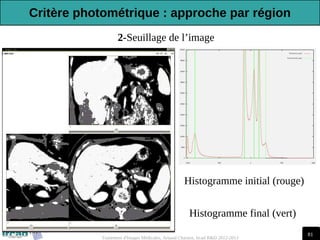 81
Traitement d'Images Médicales, Arnaud Charnoz, Ircad R&D 2012-2013
2-Seuillage de l’image
Histogramme initial (rouge)
Histogramme final (vert)
Critère photométrique : approche par région
 