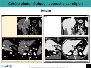82
Traitement d'Images Médicales, Arnaud Charnoz, Ircad R&D 2012-2013
Résumé
Critère photométrique : approche par région
 