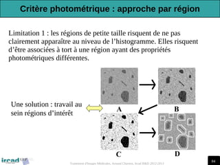 84
Traitement d'Images Médicales, Arnaud Charnoz, Ircad R&D 2012-2013
Limitation 1 : les régions de petite taille risquent de ne pas
clairement apparaître au niveau de l’histogramme. Elles risquent
d’être associées à tort à une région ayant des propriétés
photométriques différentes.
Une solution : travail au
sein régions d’intérêt
Critère photométrique : approche par région
 