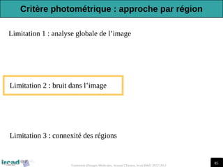 85
Traitement d'Images Médicales, Arnaud Charnoz, Ircad R&D 2012-2013
Limitation 1 : analyse globale de l’image
Limitation 3 : connexité des régions
Limitation 2 : bruit dans l’image
Critère photométrique : approche par région
 