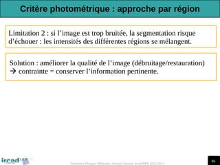 86
Traitement d'Images Médicales, Arnaud Charnoz, Ircad R&D 2012-2013
Limitation 2 : si l’image est trop bruitée, la segmentation risque
d’échouer : les intensités des différentes régions se mélangent.
Solution : améliorer la qualité de l’image (débruitage/restauration)
 contrainte = conserver l’information pertinente.
Critère photométrique : approche par région
 