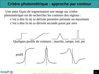 95
Traitement d'Images Médicales, Arnaud Charnoz, Ircad R&D 2012-2013
•Une autre façon de segmentation une image sur critère
photométrique est de rechercher les contours des régions :
•c’est à dire là où sa dérivée première présente un maximum
•c’est à dire là où sa dérivée seconde passe par zéro
Quelques profils de contours : marche, rampe, toit, pic
Détection de contour : dérivée première et seconde
profil
Critère photométrique : approche par contour
 