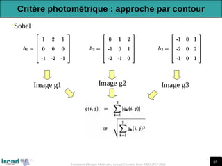 97
Traitement d'Images Médicales, Arnaud Charnoz, Ircad R&D 2012-2013
•Sobel
Image g1 Image g2 Image g3
Critère photométrique : approche par contour
 