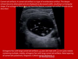 TIRADS (thyroid nodule imaging reporting and data system) Dr Ahmed ...