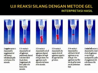 Satu gel card dapat dipergunakan untuk reaksi silang dua darah donor.