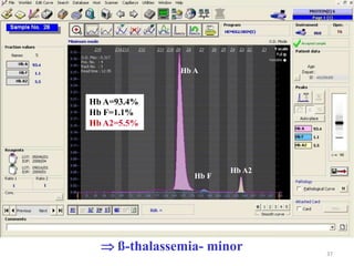 37Hb AHb A=93.4% Hb F=1.1% HbA2=5.5%Hb A2Hb F ß-thalassemia- minor