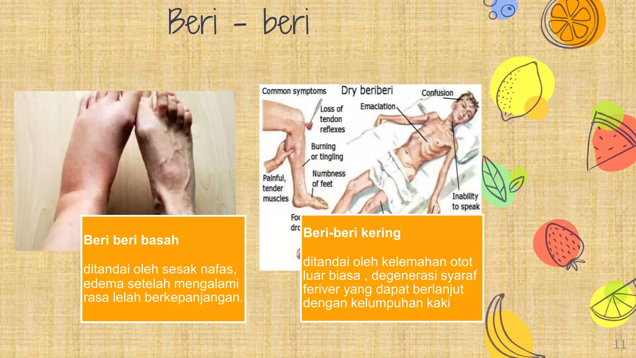 Be Ri vitamin b1 | PPTX