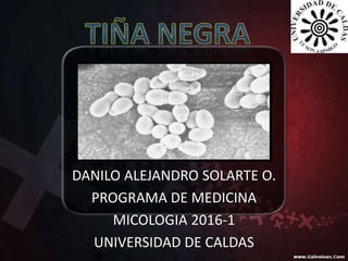 DANILO ALEJANDRO SOLARTE O.
PROGRAMA DE MEDICINA
MICOLOGIA 2016-1
UNIVERSIDAD DE CALDAS
 