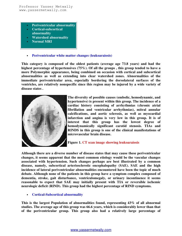 Radiological pathology of transient ischemic attacks