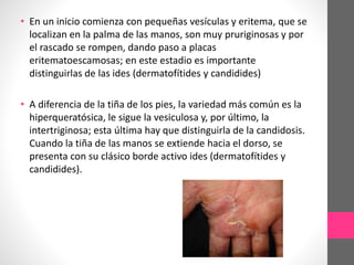 • En un inicio comienza con pequeñas vesículas y eritema, que se
localizan en la palma de las manos, son muy pruriginosas y por
el rascado se rompen, dando paso a placas
eritematoescamosas; en este estadio es importante
distinguirlas de las ides (dermatofítides y candidides)
• A diferencia de la tiña de los pies, la variedad más común es la
hiperqueratósica, le sigue la vesiculosa y, por último, la
intertriginosa; esta última hay que distinguirla de la candidosis.
Cuando la tiña de las manos se extiende hacia el dorso, se
presenta con su clásico borde activo ides (dermatofítides y
candidides).
 