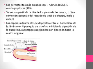 • Los dermatofitos más aislados son T. rubrum (85%), T.
mentagrophytes (10%)
• Se inicia a partir de la tiña de los pies y de las manos, o bien
como consecuencia del rascado de tiñas del cuerpo, ingle o
cabeza
• Las esporas o filamentos se depositan entre el borde libre de
la lámina y el hiponiquio de las uñas, e inician la digestión de
la queratina, avanzando casi siempre con dirección hacia la
matriz ungueal.
 