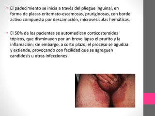 • El padecimiento se inicia a través del pliegue inguinal, en
forma de placas eritemato-escamosas, pruriginosas, con borde
activo compuesto por descamación, microvesículas hemáticas.
• El 50% de los pacientes se automedican corticosteroides
tópicos, que disminuyen por un breve lapso el prurito y la
inflamación; sin embargo, a corto plazo, el proceso se agudiza
y extiende, provocando con facilidad que se agreguen
candidosis u otras infecciones
 