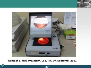Reagen: Tiap plate NOR partigen mempunyai 12 sumuran imunodifusi untuk menentukan Ig A serum/plasma.Komposisi:Cakram NOR partigen mengandung lapisan agarose gel yang mengandung antiserum monospesifik terhadap Ig A dalam plasma. Antisera diperoleh dari kelinci, domba, kuda, kambing yang diimunisasi dari manusia.Cakram NOR Partigen juga mengandung sodium azide (<1 g/l) dan sodium timerfonate (<0.1 g/l) sebagai pengawet.22