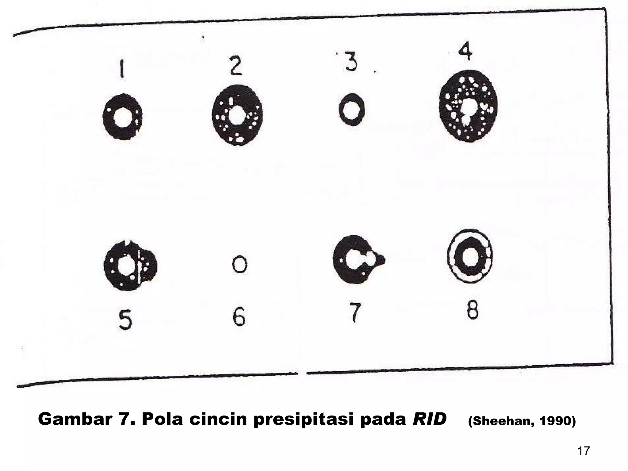 Gambar 7. Pola cincin presipitasi pada  RID (Sheehan, 1990) 