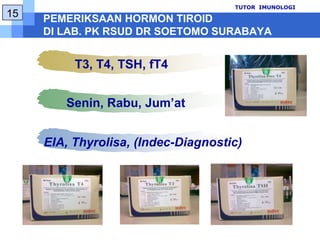 IMMUNORADIOMETRIC ASSAY (IRMA)TUTOR  IMUNOLOGI10Prinsip : ikatan non-kovalenreversibelantara antigen danantibodispesifik yang dilabeldenganradioaktifAntibodipadafasepadatAntibodiberlabelradioaktifIkatan Ag-AbspesifikSampel