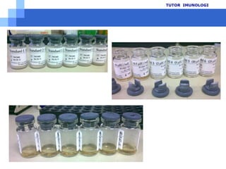 Prosedurpemeriksaan T4TUTOR  IMUNOLOGI2425 µLStandar/Sampel/KontrolCampurRata 30 ‘’InkubasiSuhukamar60’Microwells100 µLWorking conjugate reagenCampur rata 30 ‘’BuangCuci-bilas5 x100 µLSubstrate solutionHilangkansisa air dg absorbent paperInkubasiSuhukamar20’100 µLStop solutionBaca OD 450 nm, 15’