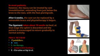 tiba shaft fracture.pptx for presentation | PPTX
