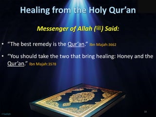 Messenger of Allah (‫)ﷺ‬ Said:
• “The best remedy is the Qur’an.” Ibn Majah:3662
• “You should take the two that bring healing: Honey and the
Qur’an.” Ibn Majah:3578
18
©Sadiqh
 