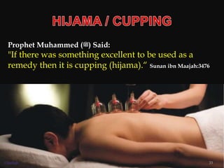 Prophet Muhammed (‫)ﷺ‬ Said:
"If there was something excellent to be used as a
remedy then it is cupping (hijama).“ Sunan ibn Maajah:3476
33©Sadiqh
 