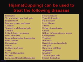 Headaches
Neck, shoulder and back pain
Hypertension
Immune system weakness
Allergies
Stomach or abdominal pain
Arthritis
Irritable bowel syndrome
Sinus Problems
Lung inflammation & coughing
Heart Disease
Rheumatism
Sciatica
Cartilage problems
Ulcers
Nerve inflammation
Diabetes
Larynx and throat inflammation
Sleep disorders
Thyroid disorders
Skin diseases
Liver disease
Edema
Urinary incontinence
Cancer
Kidney inflammation or stones
Osteoporosis
Tinnitus
Influenza
Hemiplegia and paralysis
Foot pain
Back pain, stiff legs
Impotence
Infertility
Tooth or gum pain
Speech difficulties
37
©Sadiqh
 