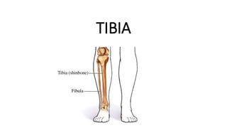 TIBIA n | PPTX
