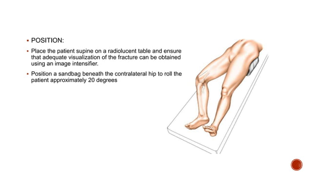 Proximal Tibia Surgical approaches | PPTX | Death, Injury, or Military ...