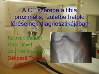 A CT szerepe a tibia proximális, ízületbe hatoló töréseinek diagnosztikájában ,[object Object],[object Object],[object Object],[object Object]