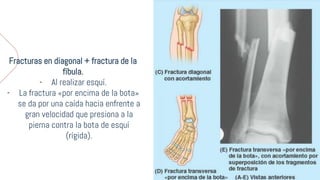 Tibia, fíbula, huesos del pieSCRIBDD.pptx