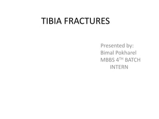 TIBIA FRACTURES
Presented by:
Bimal Pokharel
MBBS 4TH BATCH
INTERN
 