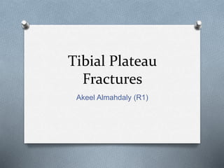 Tibial Plateau
Fractures
Akeel Almahdaly (R1)
 
