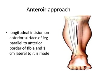 tibial plateau fracture and its management.pptx
