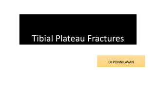 Tibial Plateau Fractures
Dr.PONNILAVAN
 