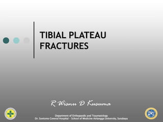 TIBIAL PLATEAUTIBIAL PLATEAU
FRACTURESFRACTURES
R Wisnu D Kusuma
 