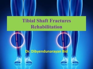 Tibial Shaft Fractures
Rehabilitation
Dr. Dibyendunarayan Bid
 
