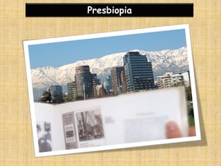 Presbiopia