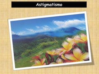 Astigmatismo
 