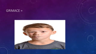 GRIMACE =
 