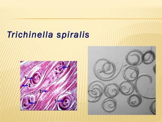 Trichinella spiralis
 