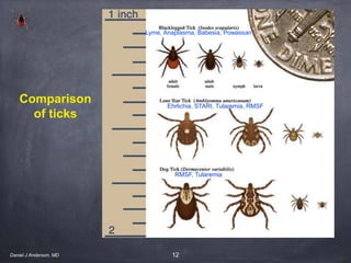 12
Comparison
of ticks
Lyme, Anaplasma, Babesia, Powassan
Ehrlichia, STARI, Tularemia, RMSF
RMSF, Tularemia
Daniel J Anderson, MD
 