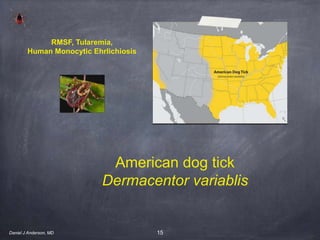 15
American dog tick
Dermacentor variablis
RMSF, Tularemia,
Human Monocytic Ehrlichiosis
Daniel J Anderson, MD
 