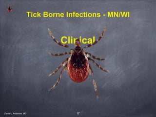 17
Clinical
Tick Borne Infections - MN/WI
Daniel J Anderson, MD
 
