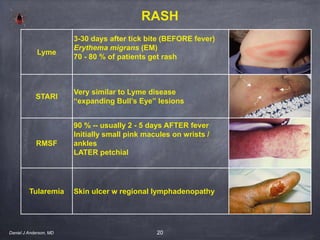20
Lyme
3-30 days after tick bite (BEFORE fever)
Erythema migrans (EM)
70 - 80 % of patients get rash
STARI
Very similar to Lyme disease
“expanding Bull’s Eye” lesions
RMSF
90 % -- usually 2 - 5 days AFTER fever
Initially small pink macules on wrists /
ankles
LATER petchial
Tularemia Skin ulcer w regional lymphadenopathy
RASH
Daniel J Anderson, MD
 