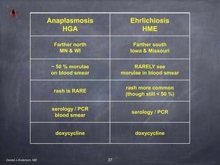 37Daniel J Anderson, MD
Anaplasmosis
HGA
Ehrlichiosis
HME
Farther north
MN & WI
Farther south
Iowa & Missouri
~ 50 % morulae
on blood smear
RARELY see
morulae in blood smear
rash is RARE
rash more common
(though still < 50 %)
serology / PCR
blood smear
serology / PCR
doxycycline doxycycline
 