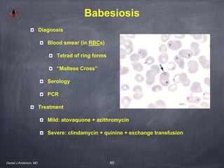 40
Babesiosis
Diagnosis
Blood smear (in RBCs)
Tetrad of ring forms
“Maltese Cross”
Serology
PCR
Treatment
Mild: atovaquone + azithromycin
Severe: clindamycin + quinine + exchange transfusion
Daniel J Anderson, MD
 