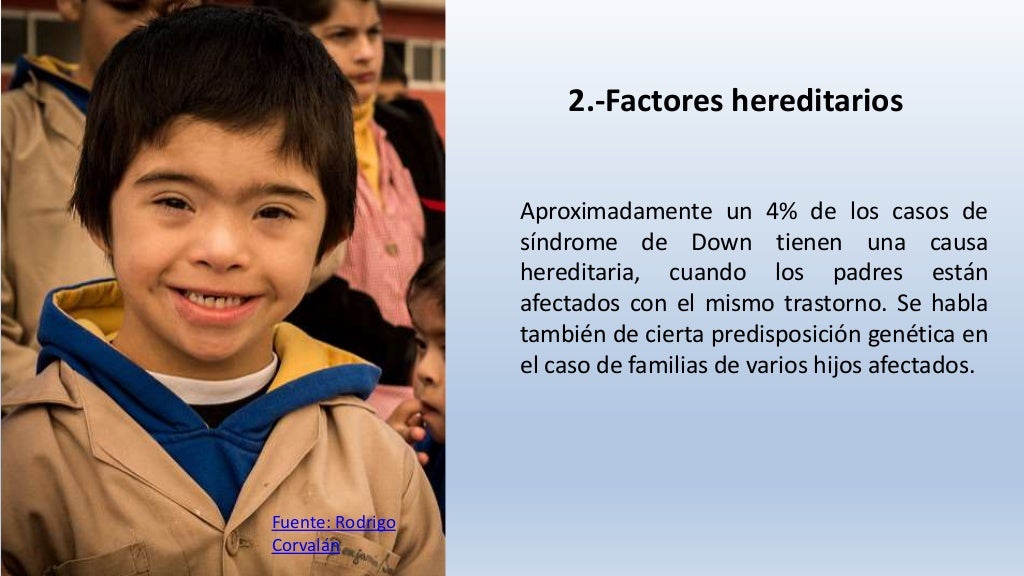 Causas del síndrome de Down